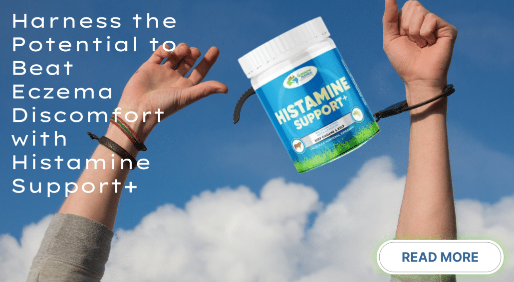 Harness the Potential to Beat Eczema Discomfort with Histamine Support+